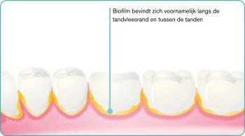 NL-explore-image-oral-care-vap-facts-2