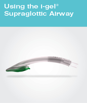 i-gel Supraglottic Airway - Posters